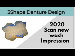 3Shape Denture Design Scan New wash impression
