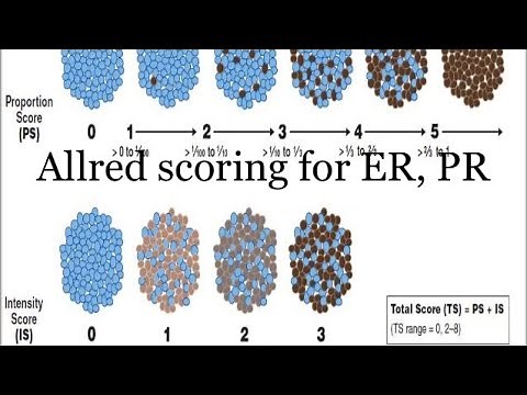 ALLRED Scoring for ER, PR in Breast Cancer