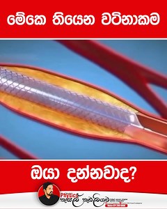 2.5M views · 10K reactions | මේකෙ තියෙන වටිනාකම ඔයා දන්නවාද?❤️❤️ . . . . #physics_with_KK #シ゚viralシfypシ゚viralシalシlシ #kusalkudaligama #genuinephysics #viralvideochallenge #virals #viralreelsfacebook #physics #quotes #motivation #motivationalquotes #motivationalvideo #lecture #srilankaඋත්සහය | Physics with Kusal Kudaligama - කුසල් කුඩලිගම | Facebook