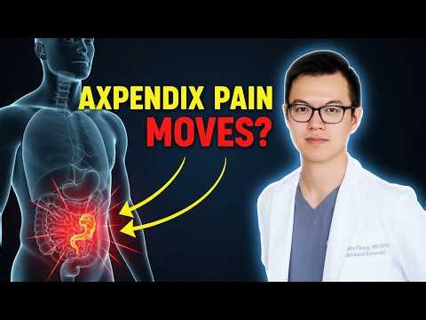 Appendicitis – Symptoms and Reasons Behind Appendix Pain | Dr. Austin Chiang