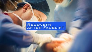 Recovery After Facelift