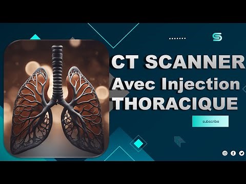 CT Scanner THORACIQUE (Avec Injection) - Partage de Pratiques