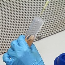 Video: Candida albicans Biofilm Development on Medically-relevant Foreign Bodies in a Mouse Subcutaneous Model Followed by Bioluminescence Imaging