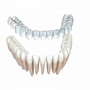 56K views | Hey Colchester!  Ready to love your smile again? Join...