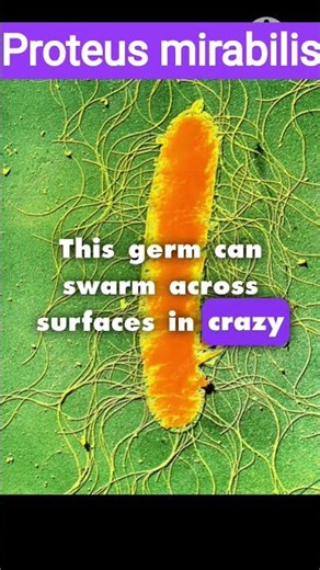 The Sneaky Bacterium – Proteus mirabilis! 🦠" #ScienceFacts #Microbiology