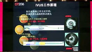 IVUS的临床应用与影像基础
