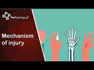 Mechanism of injury