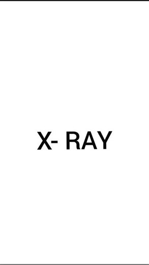 x ray history basis of x ray in short #shorts#radiology.