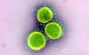 Public health expert says ‘zero doubt’ most U.S. virus deaths were avoidable