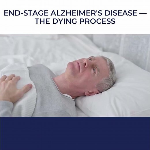 Uncovering the Reality of End-Stage Alzheimer's: How the Dying Process Unfolds 😶‍🌫