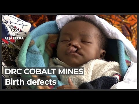 Babies born with deformities near DRC’s cobalt mines