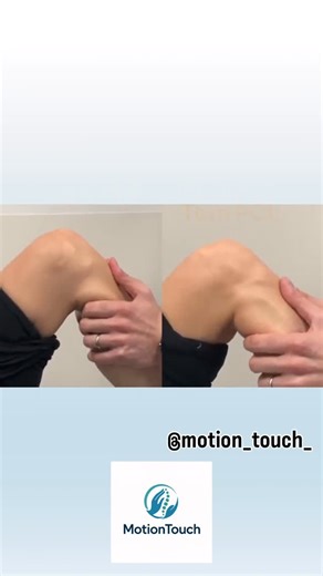 MotionTouch PHYSIOTHERAPY | Posterior Drawer Test – a key special test to assess the integrity of the posterior cruciate ligament (PCL) of the knee 👇 With the patient... | Instagram
