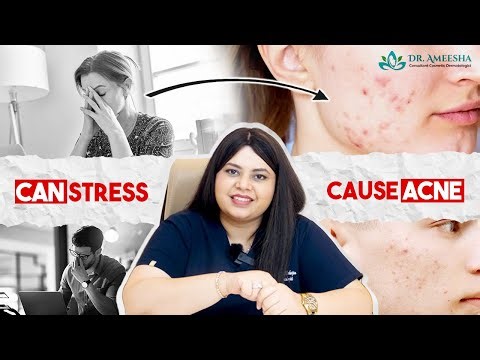 Stress Causing Acne: Watch this! #StressAndAcne#acneawareness #clearskinjourney