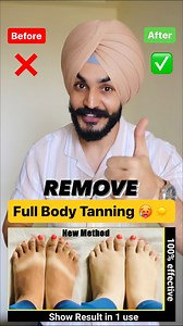 ☀️ “Remove sun tanning” Fast. SAVE 📌 tips. Apply sunscreen & AHA BHA body lotion for instant results. #tan #detan #skin #skincare #skincareroutine #skincaretips #skincareproducts #tanning #sunburn #summer | Santwinder Singh Waraich