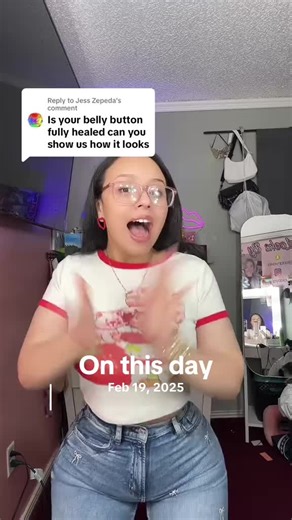 #onthisday a year ago today I showed you guys my belly button #tummytuck