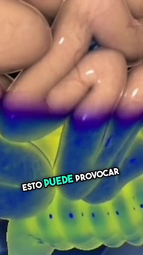 ¿Qué pasa si se revienta el apéndice? Síntomas y riesgos