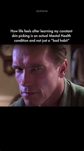 Finding Out Skin Picking Is an Actual Condition 🥹 #dermatillomania #skinhealing #mentalhealth