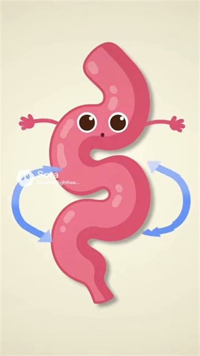 Intestinal Volvulus Explained in 10 Seconds – Early Detection Matters #shortvideo