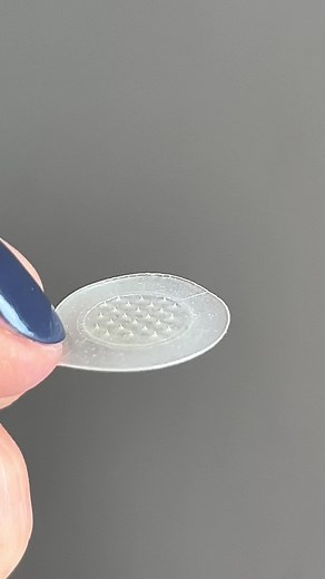 Clear Your Skin with KILLA Acne Patch by Zitsticka