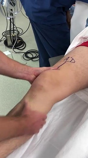 Knee Exam Under Anaesthesia (EUA) - ACL rupture