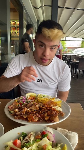 #downsyndrome #foryou #foryoupage #viral #goviral #fyfyfyfyfyfyfyfyfyfyfyfyfyfyfyfyfyfyfy #ffm