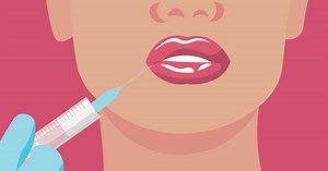 Ces injections d’acide hyaluronique “maison” font le buzz