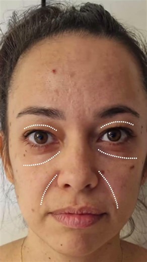 GLOW Program Transformations