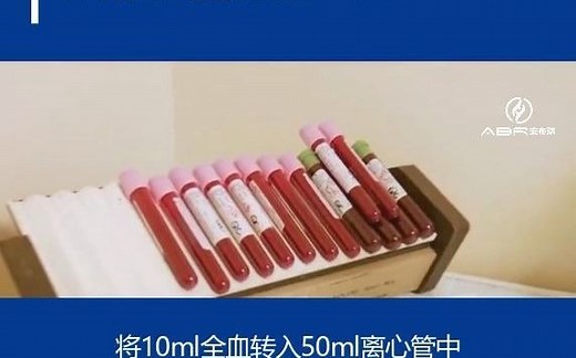 【生物医学实验室日常】PBMC分离流程