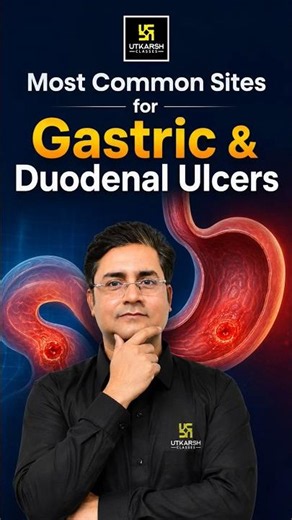 Most Common Sites for Gastric & Duodenal Ulcers ✨ #nursingexam2026 #nursingpreparation