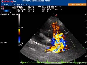 CONDUCTO ARTERIOSO PERSISTENTE