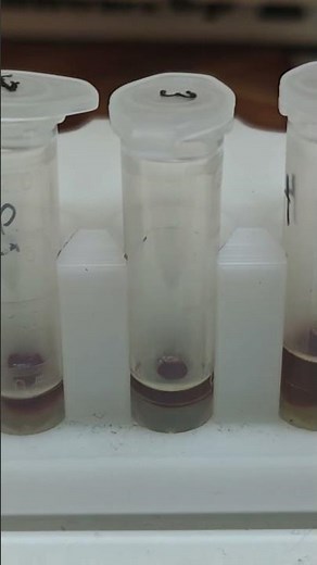 DNA extraction and purification using magnetic beads #dna #biotech #ukraine