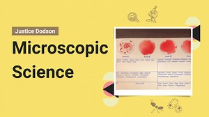 What’s Your Blood Type? AB- is Super Rare!