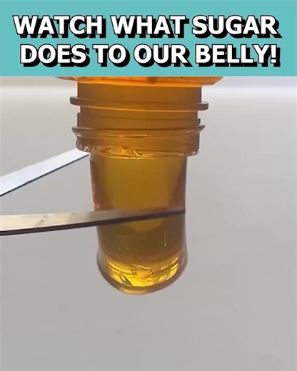 77 reactions · 12 shares | Who knew that your gut type could reveal so much about how you digest food, manage weight, and EVEN how you store energy? And one of the biggest factors for GUT health: SUGAR! 磻 This 30-Sec FREE quiz completely changed my perspective on how to trim those hard-to-lose pounds. Finally, I see results! Take the quiz to discover your specific gut-type lnk.to/GutQuiz | Gundry MD | Facebook