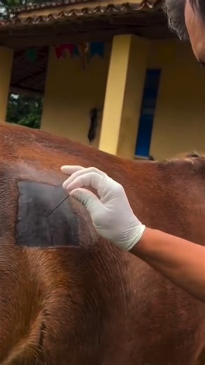 Dr Osama Javed on Instagram: "Trocarization is an emergency veterinary procedure used to rapidly relieve gas pressure in a horse’s large intestine, which is often caused by severe gas colic or tympany. It involves a veterinarian inserting a sharp trocar (a metal instrument inside a hollow cannula) through the abdominal wall, usually on the right side of the flank, to puncture the gas-distended cecum or colon. This allows the trapped gas to escape, providing immediate relief, although it is a pal