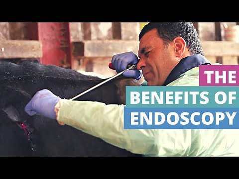 The Benefits of Endoscopy