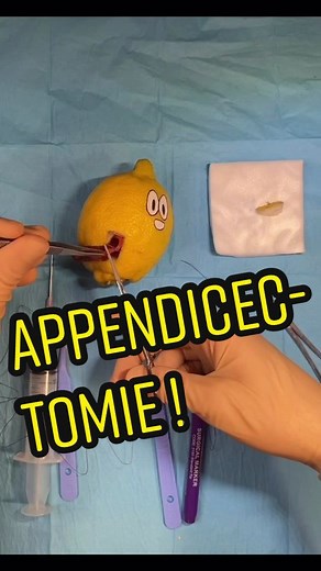 Appendicite : Opération de Martin en Direct