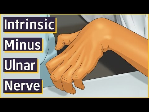 Intrinsic Minus | Ulnar Nerve Injury