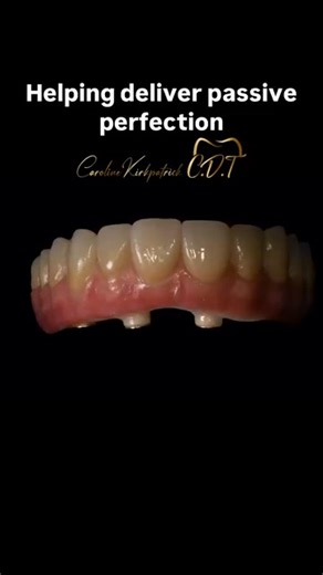 🦷✨ Scan Ladder in the lab: passive perfection made predictable. Brilliant walkthrough by @carolinekirkpatrick.c.d.t, showing how Scan Ladder isn’t just a clinic tool… it’s a powerful validation system for lab technicians too. By comparing the intraoral scan with the analogue model using Scan Ladder Medit i900, discrepancies were confirmed instantly, leading to a precise, passive-fit digital workflow. The final zirconia bridge, finished with IPD Ti bases from @online_dental, demonstrates exactly