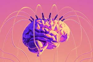 Neurotech Companies Are Selling Your Brain Data