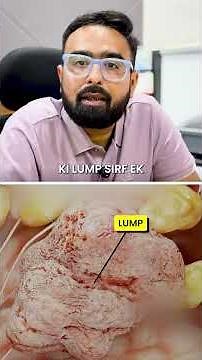 Fast Growing Breast Lump? Phyllodes Tumor vs Fibroadenoma Explained