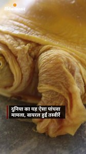 130K views · 298 reactions | नई खोज: नेपाल में सुनहरे रंग वाले दुर्लभ...