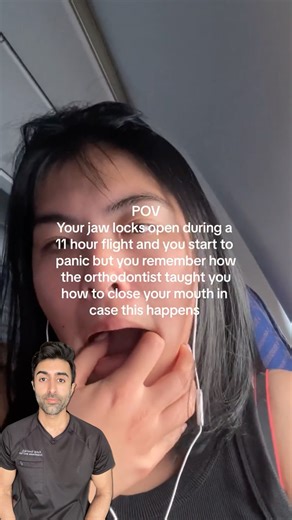 Ever felt your jaw suddenly freeze mid-yawn? 😬 That’s called trismus, when the jaw muscles spasm or the joint locks up after dental work or too much strain. Warm compress, gentle motion, and a soft diet can help, but forcing it open can make it worse. 🚨 Have you ever experienced your jaw locking like this? VC: @joygriesel Follow @doctorsoood to improve your health IQ and for similar content. #lockedjaw #trismus #tmj #jawpain #medical | Kunal Sood, MD