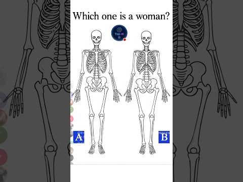 Which One Is a Woman 🤔 Skeleton IQ TestChallenge.