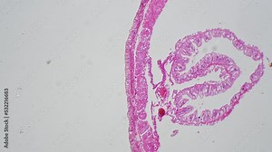 Static microscopic footage of earthworm in transversal section 100x on bright field background. Macro view of cross cut invertebrate life being prepared for the education at school on biology lesson