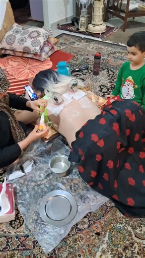 ‎شما را دنبال میکند‎ on Instagram‎: "رفتم روستا پیش مادربزرگ تا فقط یه دل سیر استراحت کنم… ولی هنوز پنج دقیقه نگذشته بود که گفت: «تو چشم‌خورده‌ای، باید بادکش کنم!» حالا منم و این گردی‌های بنفش که ثابت می‌کنه عشقِ مادربزرگ همیشه با یه کم درمان سنتی قاطی می‌شه. 😂💜 #بادکش_محلی #عشق_مامان‌بزرگ I went to the village to relax at my grandma’s place… But after five minutes she said, “You’ve got the evil eye, let me do some cupping!” So here I am, with a bunch of purple circles that prove grandma’s lov