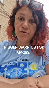 2.7K views · 30 reactions | Please sign both of these petitions: https://chng.it/5hSRXLQtjP and https://www.change.org/p/stop-amazon-from-selling-dangerous-ableist-curist-harmful-books-on-autism?fbclid=IwY2xjawKeqyxleHRuA2FlbQIxMQABHsvJNchO_7hYiR5T9a1FIP0l4XmEUhlOakjRIPeUN1dpOJqdsgOqt2GX3ImY_aem_b6pwjNcR9FNUT_z3O_B25Q | Autistic Inclusive Meets Community Group AIM | Facebook