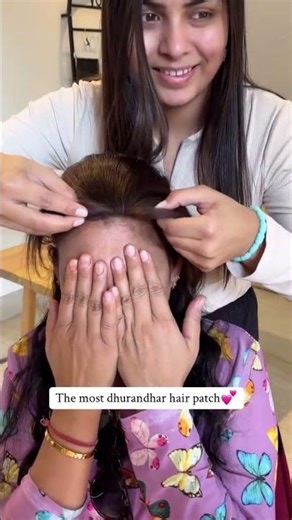 Front Hairline Patch for Forehead Hair Thinning | Natural Hairline Cover for Women | The Shell Hair