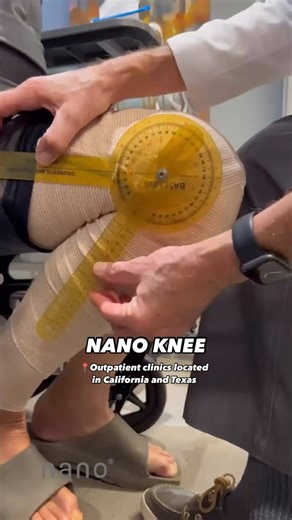 Nanoknee on Instagram: "Nano Knee is a minimally invasive procedure designed to restore your knee’s full function and strength with minimal recovery time. 🙌 Our outpatient clinics are conveniently located in: 📍 Arroyo Grande, CA 📍 Rancho Cucamonga, CA 📍 Downey, CA 📍 West Los Angeles, CA 📍 Century City, CA 📍 Burbank, CA 📍 Sherman Oaks, CA 📍 Thousand Oaks, CA 📍 Moorpark, CA 📍 Mesquite, TX 📍 The Woodlands, TX 📍 Humble, TX — #orthopedicsurgeon #orthopedicsurgeons #kneereplacement #getmo