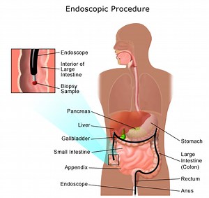 How does gas enter the digestive system? [2025] | QAQooking.wiki