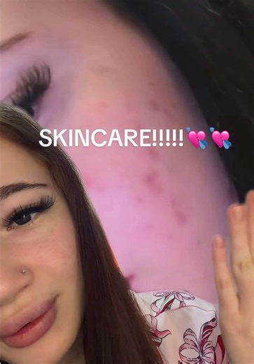 sper ca v a ajutat ca am primit multe mesaje in ultimu timp legate de asta!!! (si pimple patchuri cele mai bune sunt acnemy sau mighty patch) #skincare #skincareromania #panoxyl #pentrutine #viral